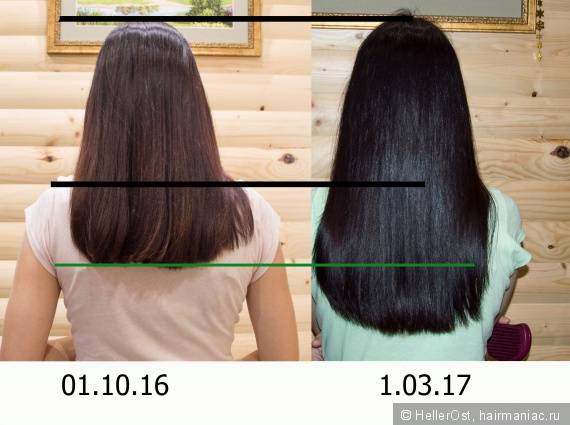 Насколько быстро растут. Волосы выросли за год. Насколько растут волосы. Волось отрасли за месяц. Рост волос за месяц.