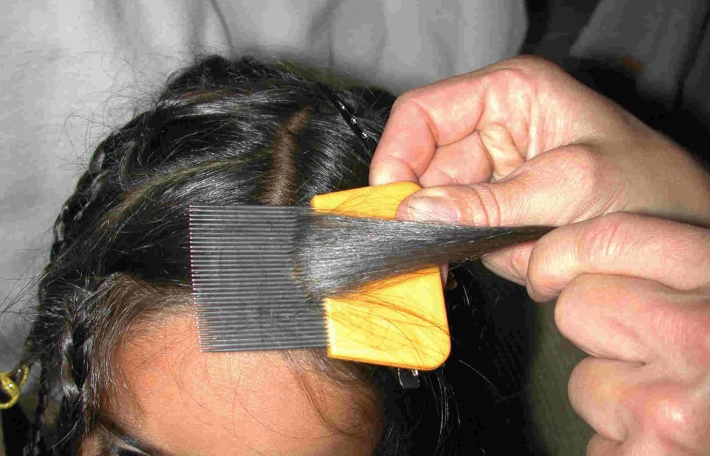 Что может показать экспертиза волоса