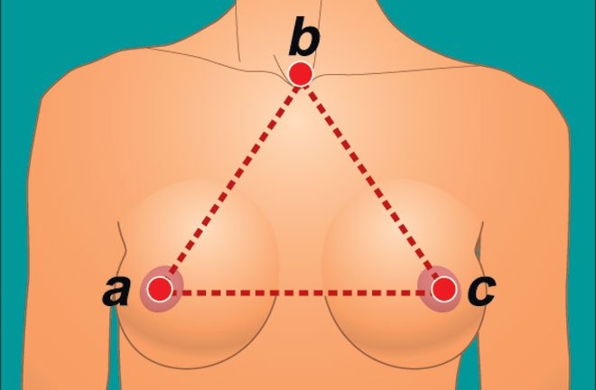 форма груди