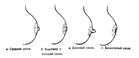 виды сосков