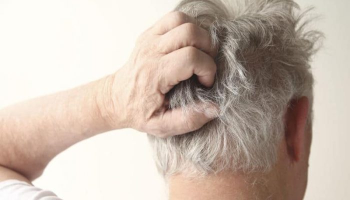 Почему появились болячки в волосах на голове? Основные причины и лечение у взрослых и детей