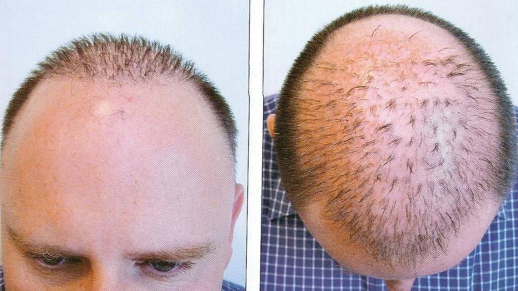 Последствия стрижки или бритья волос в апреле