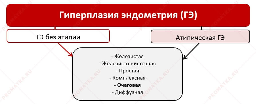 Схема видов гиперплазии эндометрия