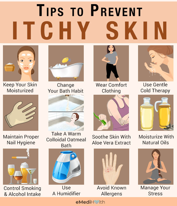 prevent itchy skin