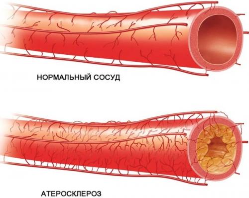 Холодные руки и ноги лечение. Причины холодных конечностей